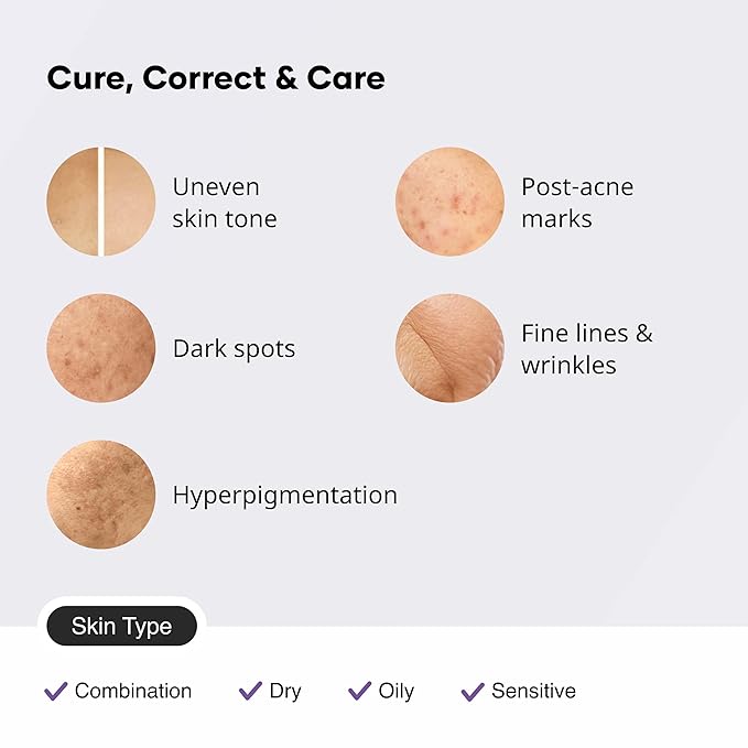 Cureskin Multi-Active Corrector Kojic Acid Face Cream | Kojic Acid, Alpha Arbutin & Niacinamide | For Uneven Skin Tone, Dullness & Visible Spots, 0.53 Ounce (Pack of 1)