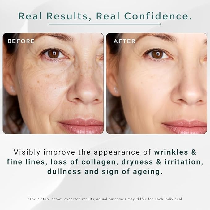 Retinol 4.5% + Hyaluronic Acid 10% - Advanced Anti-Aging Face Serum for Dark Spots, Fine Lines & Wrinkles - Deep Hydration for Radiant, Glowing Skin - 1fl. oz