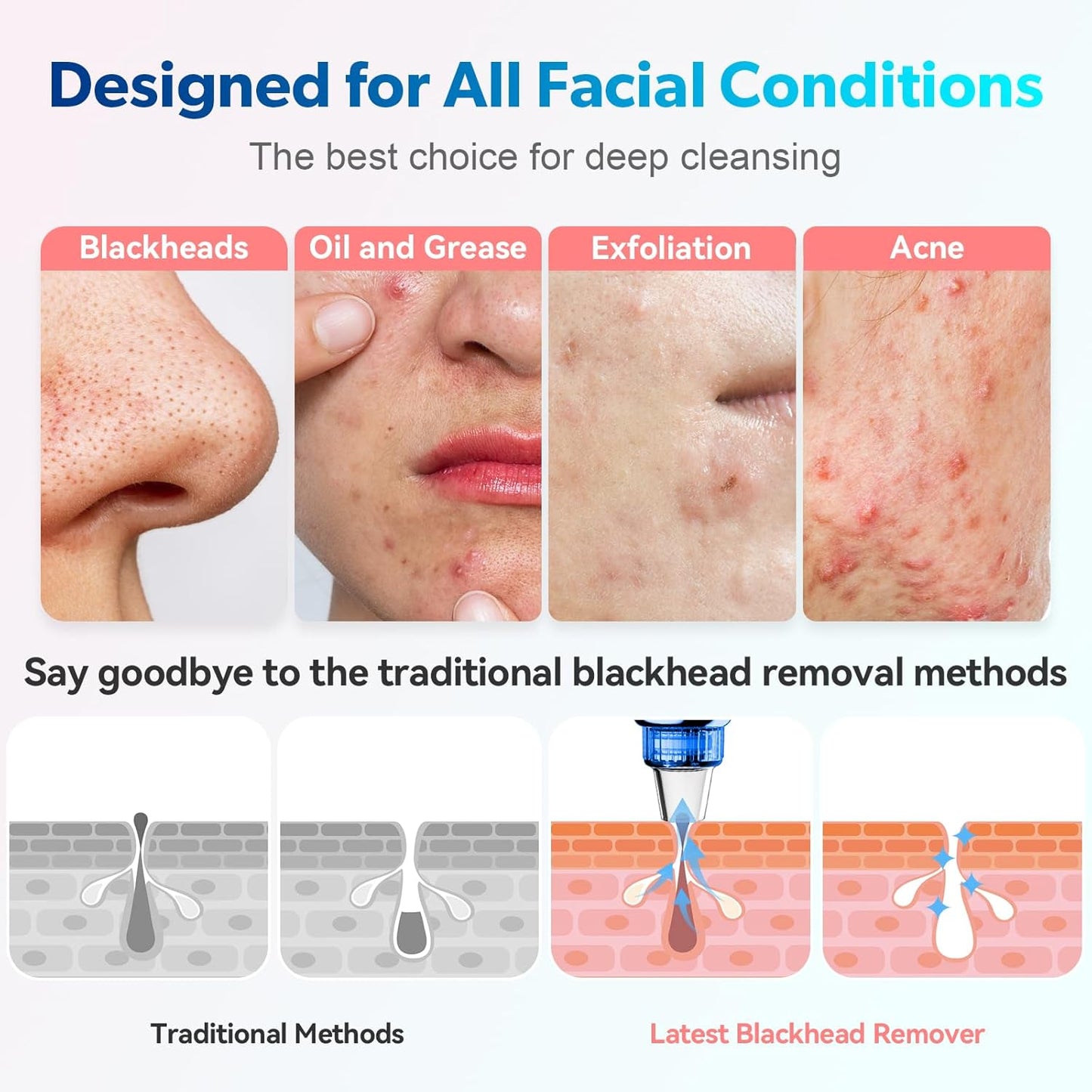 Blackhead Remover Pore Vacuum Upgraded Facial Pore Cleaner Electric Comedone Whitehead Extractor Tool-5 Suction Power,5 Probes,USB Rechargeable