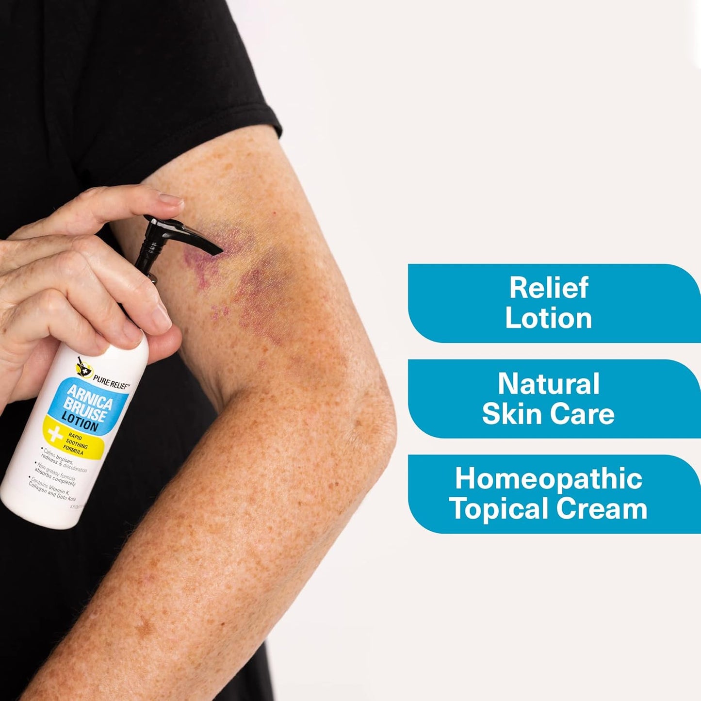 Arnica Bruise Relief Lotion for Bruising, Swelling, & Discoloration On Skin, Natural Skin Care Arnica Bruise Homeopathic Topical Bruise Cream W/Aloe Vera & Collagen, 4 Fl Oz (Pack of 3)