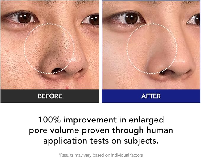 35% Smaller Pores & 32% Reduced Pore Area – Improves Skin Texture by 8% – Soothes, Hydrates & Brightens with CICA Exosomes, AHA/BHA/PHA & Fruit Enzymes – Korean Skincare Favorite Toner Pad Kioskin
