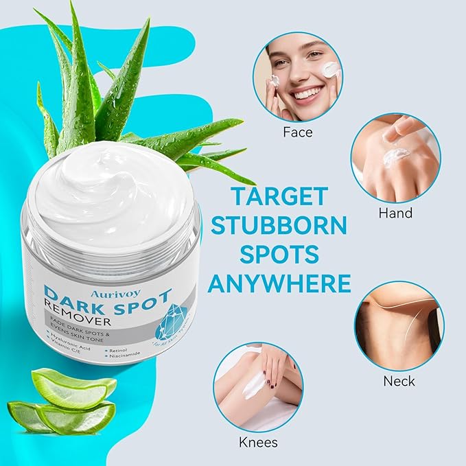 Dark Spot Remover for Face and Body – Dark Spot Corrector Serum for All Skin Types – Fades Age Spots, Sun Spots, Melasma, Freckles – Anti-Aging Fade Cream for Uneven Skin Tone 1.7 Fl Oz