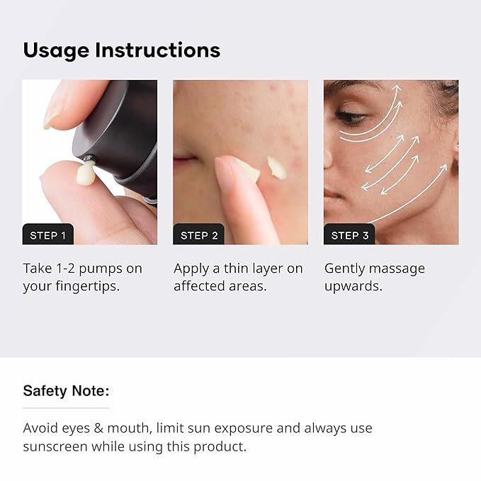 Cureskin Multi-Active Corrector Kojic Acid Face Cream | Kojic Acid, Alpha Arbutin & Niacinamide | For Uneven Skin Tone, Dullness & Visible Spots, 0.53 Ounce (Pack of 1)
