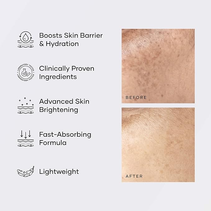 Cureskin Multi-Active Corrector Kojic Acid Face Cream | Kojic Acid, Alpha Arbutin & Niacinamide | For Uneven Skin Tone, Dullness & Visible Spots, 0.53 Ounce (Pack of 1)