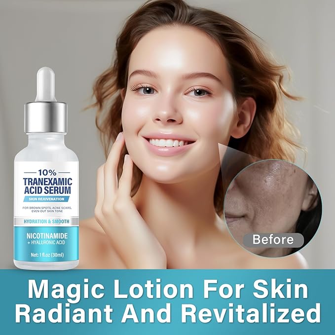 Tranḛxamic Acid 10% Serum, Discoloration Correcting Serum, Face Lotion with Moisturizing Effect, Natural Formula for Skincare